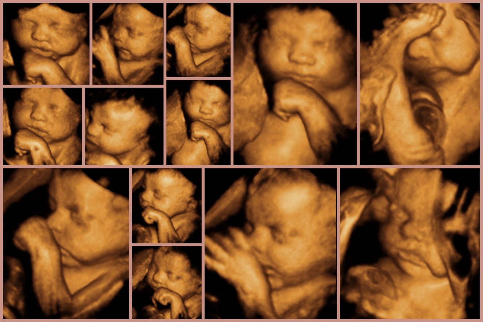 Ekspertski 4d Ultrazvuk Za 3500 Din U Poliklinici Gracia Medika Koce Popovica 7 Beograd