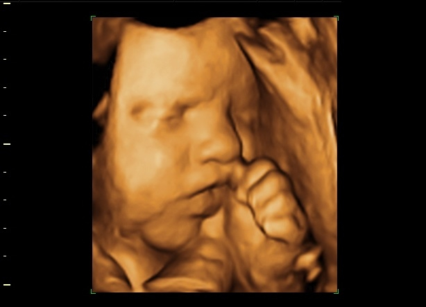 Ekspertski 4d Ultrazvuk Za 3500 Din U Poliklinici Gracia Medika Koce Popovica 7 Beograd